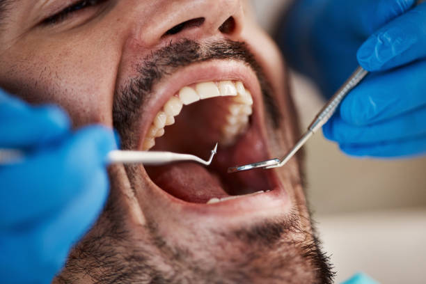 Best Emergency Tooth Extraction  in Bonduel, WI